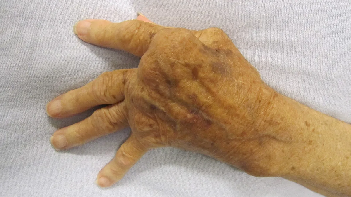 Arthritis In Senior Cats