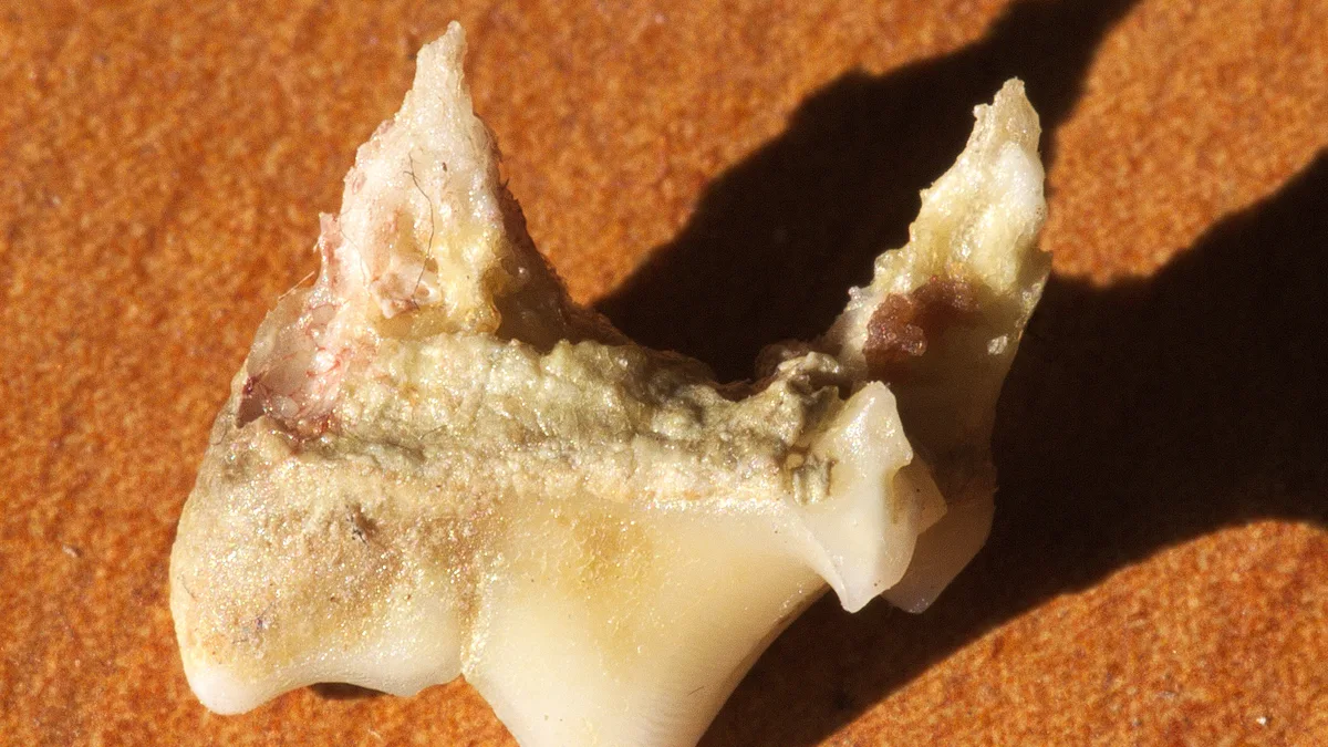 Dental Resorptive Lesions